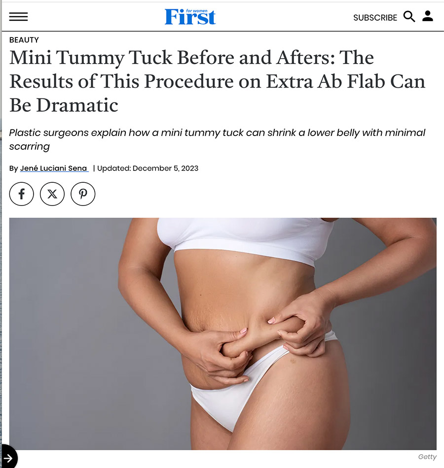 First for women tummy tuck article